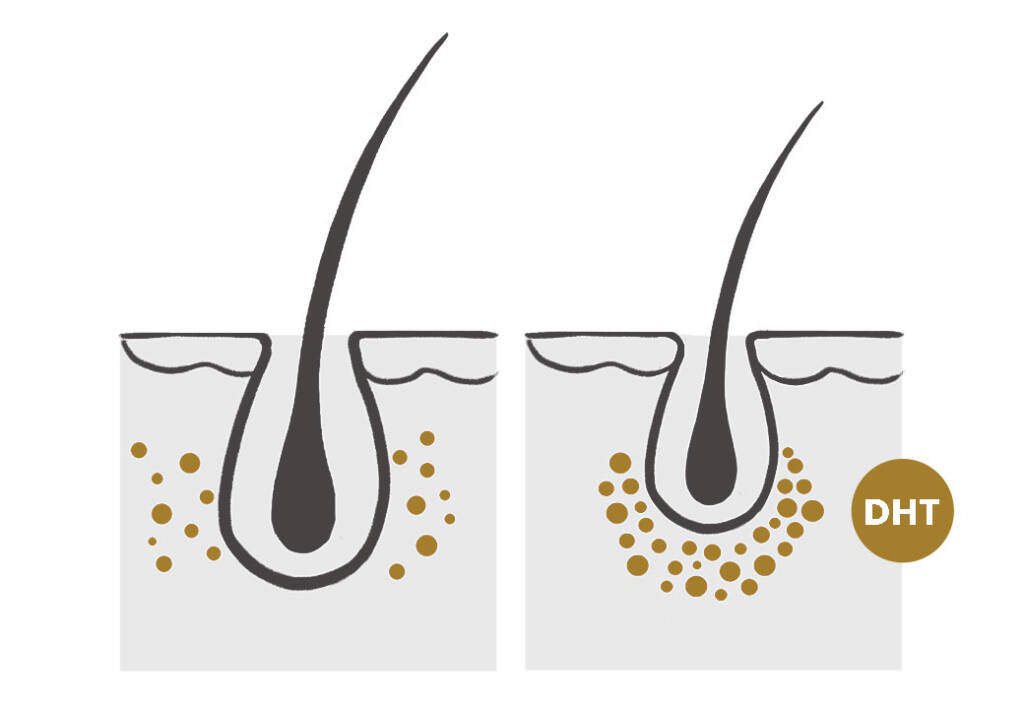 Hair loss – Hair Science Clinic